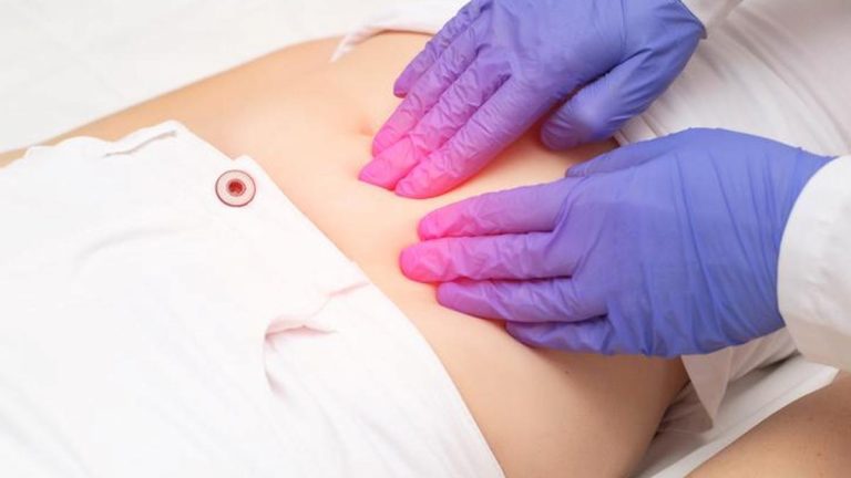 Çikolata Kisti Belirtileri Nelerdir? Çikolata Kisti Nasıl Anlaşılır? Tedavi Yöntemleri Nelerdir?